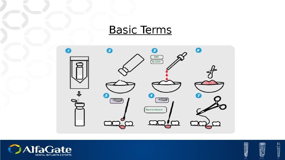 Basic Terms 