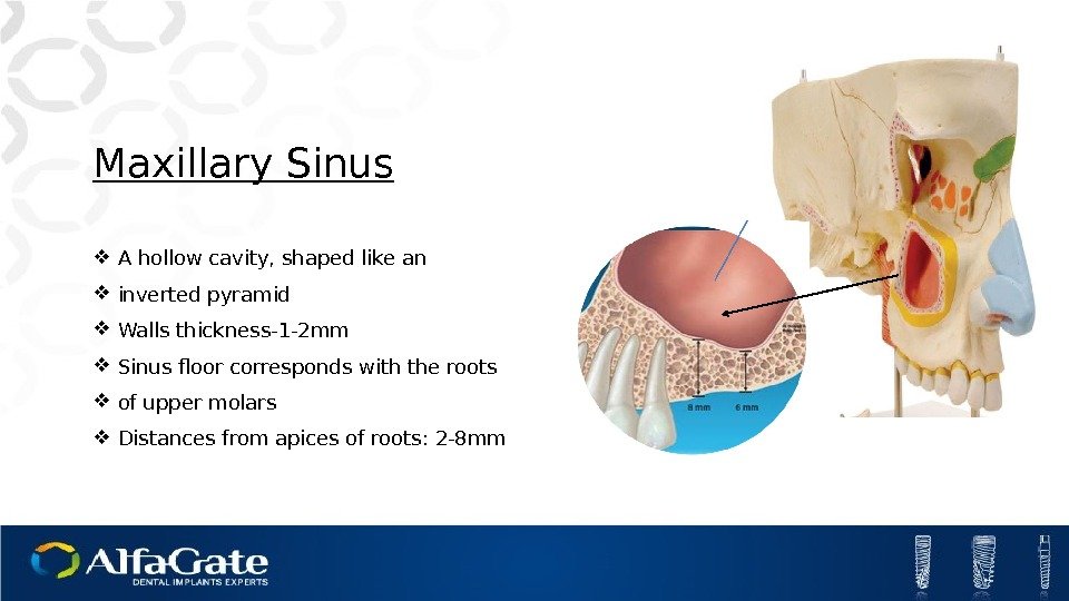 Maxillary Sinus A hollow cavity, shaped like an inverted pyramid Walls thickness-1 -2 mm
