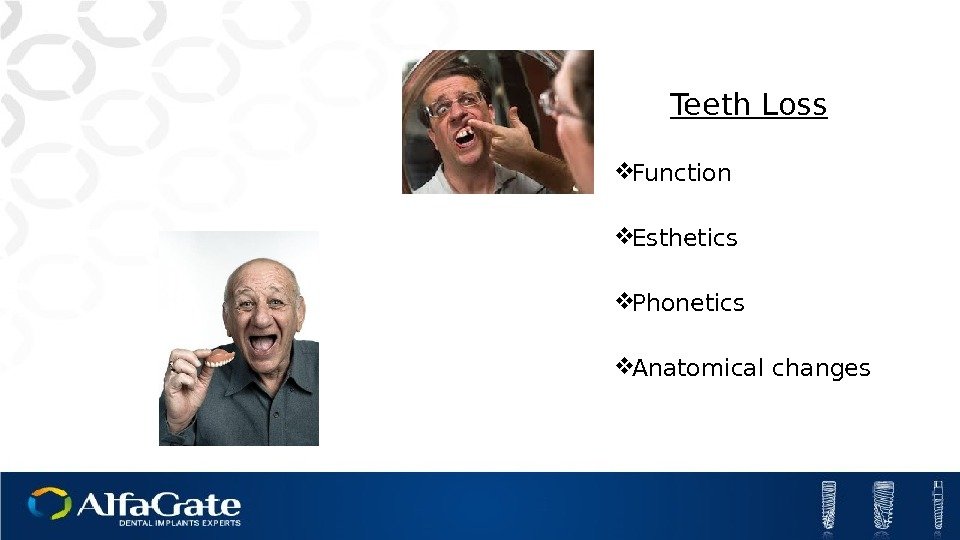 Teeth Loss Function Esthetics Phonetics Anatomical changes 
