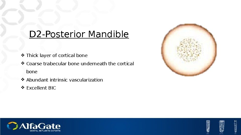 D 2 -Posterior Mandible Thick layer of cortical bone Coarse trabecular bone underneath the