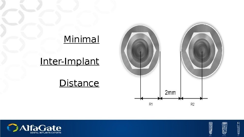 Minimal Inter-Implant Distance 