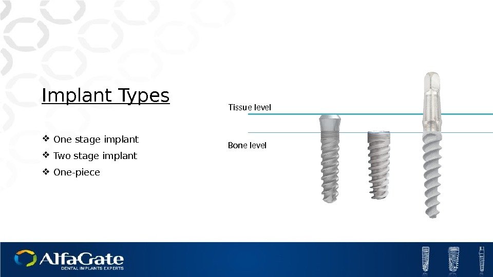 Implant Types One stage implant Two stage implant One-piece Bone level Tissue level 