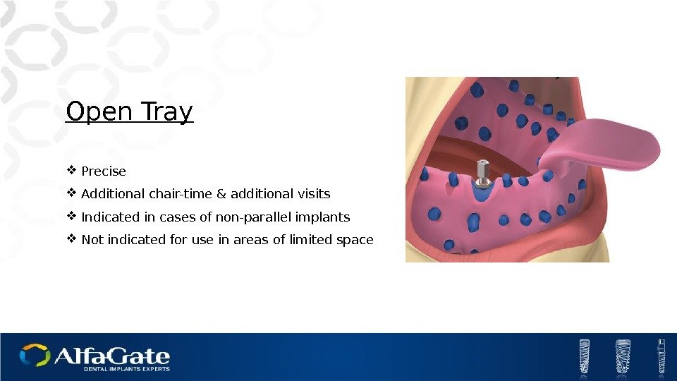 Open Tray Precise Additional chair-time & additional visits Indicated in cases of non-parallel implants