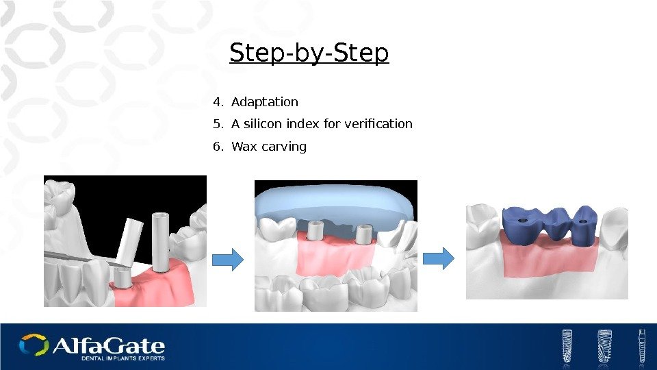 4. Adaptation 5. A silicon index for verification 6. Wax carving. Step-by-Step 