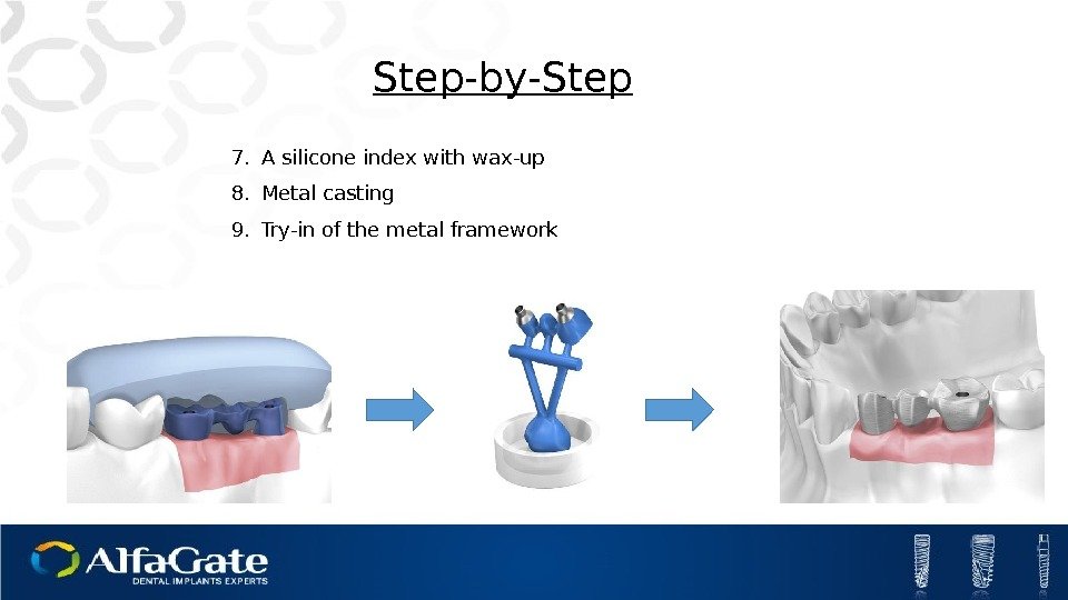 7. A silicone index with wax-up 8. Metal casting 9. Try-in of the metal