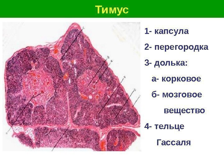   Тимус 1 - капсула 2 - перегородка 3 - долька: а- корковое