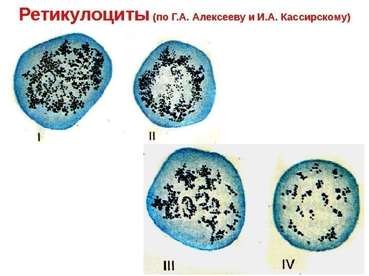   Ретикулоциты (по Г. А. Алексееву и И. А. Кассирскому) 