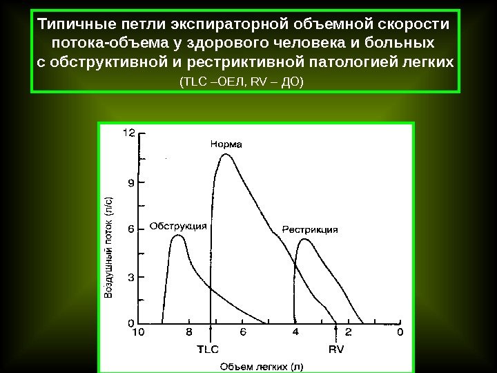  Типичные петли экспираторной объемной скорости потока-объема у здорового человека и больных с
