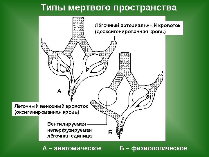   Типы мертвого пространства А – анатомическое  Б – физиологическое. Лёгочный артериальный