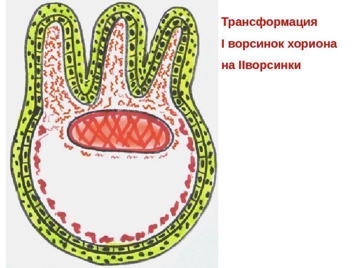   Трансформация I ворсинок хориона на II ворсинки 