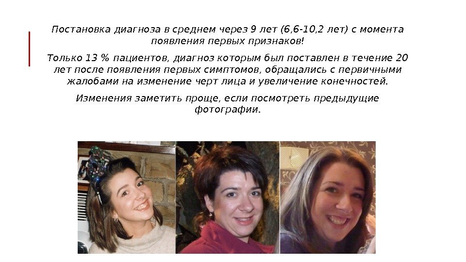  Постановка диагноза в среднем через 9 лет (6, 6 -10, 2 лет) с