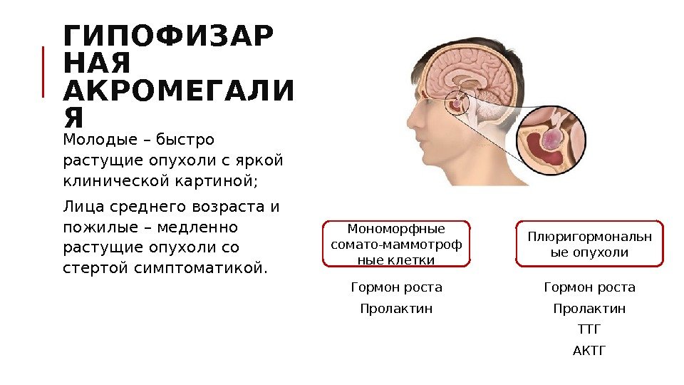 ГИПОФИЗАР НАЯ АКРОМЕГАЛИ Я Молодые – быстро растущие опухоли с яркой клинической картиной; Лица