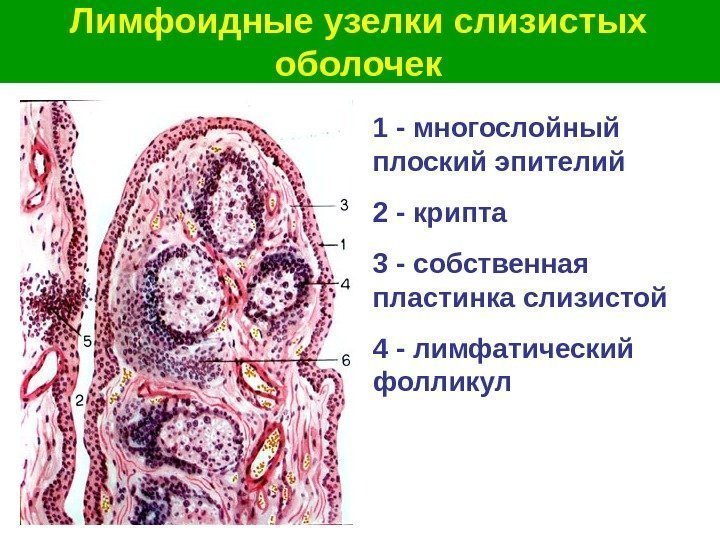   Лимфоидные узелки слизистых оболочек 1 - многослойный  плоский эпителий 2 -