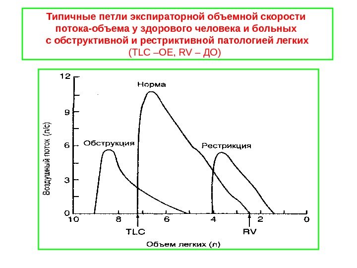 Типичные петли экспираторной объемной скорости потока-объема у здорового человека и больных с обструктивной и