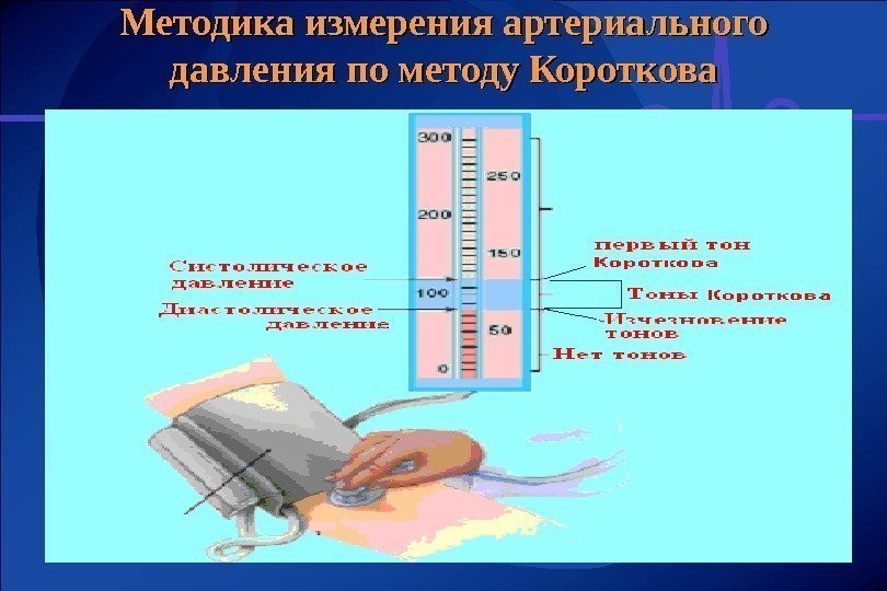 Методика измерения артериального давления по методу Короткова 