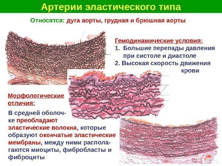   Артерии эластического типа Относятся:  дуга аорты, грудная и брюшная аорты Гемодинамические
