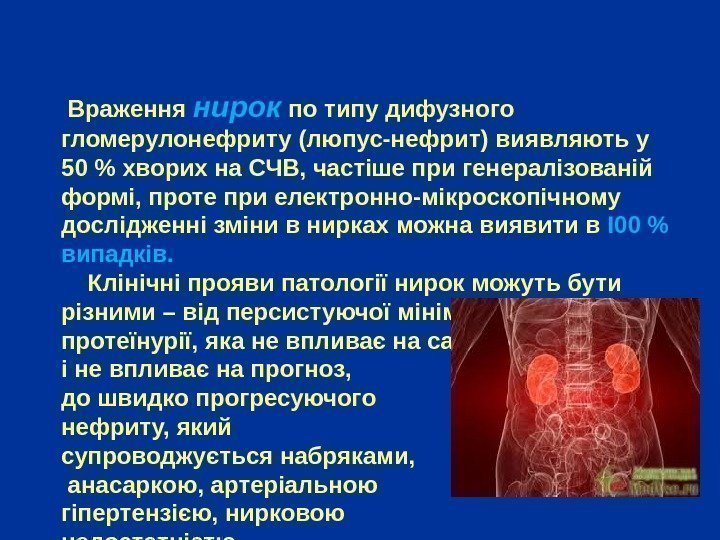    Враження нирок по типу дифузного гломерулонефриту (люпус-нефрит) виявляють у 50 