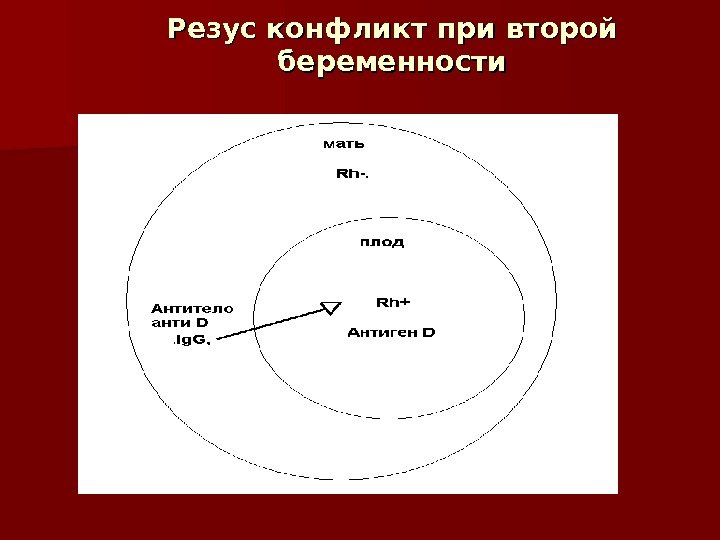 Резус конфликт при беременности презентация