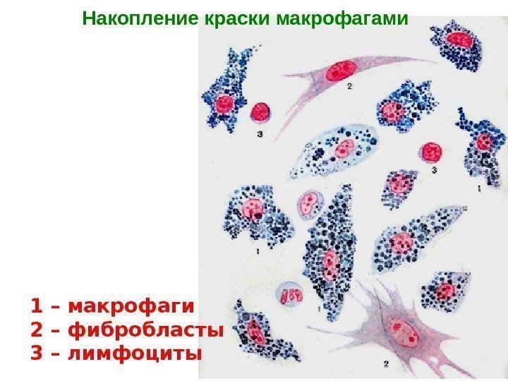  Накопление краски в макрофагах РВСТ 1 – макрофаги 2 – фибробласты 3