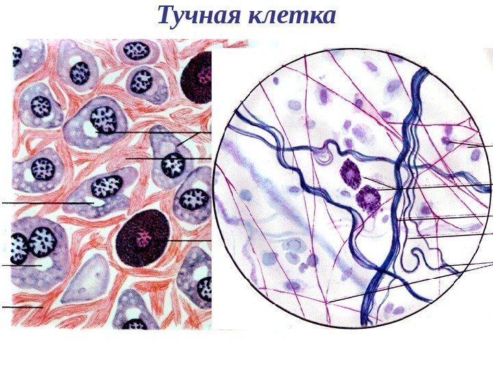  Тучная клетка 