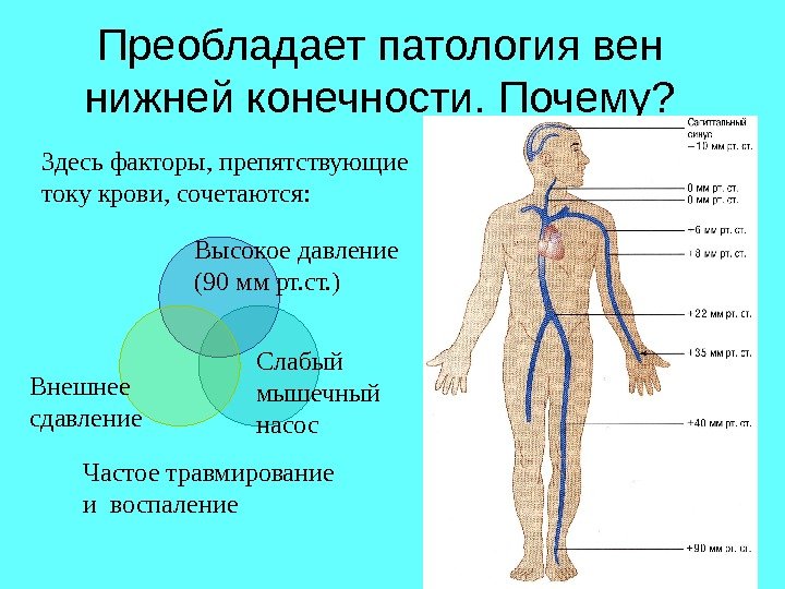 Преобладает патология вен нижней конечности. Почему? Здесь факторы, препятствующие току крови, сочетаются:  Высокое