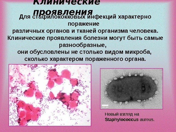 Для стафилококковых инфекций характерно поражение  различных органов и тканей организма человека.  Клинические