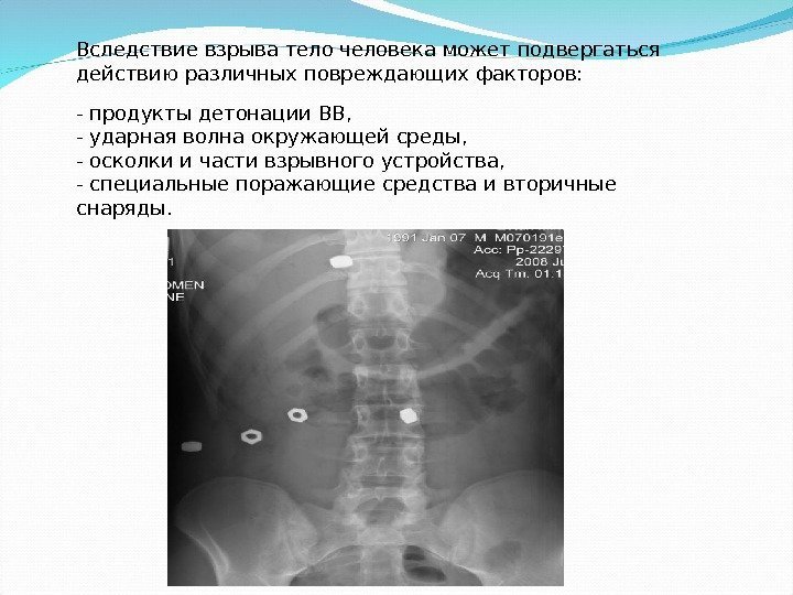 Вследствие взрыва тело человека может подвергаться действию различных повреждающих факторов: - продукты детонации ВВ,