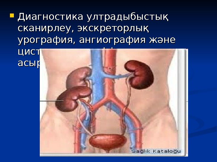  Диагностика ултрадыбыстық сканирлеу, экскреторлық урография, ангиография және цистоскопия негізінде жүзеге асырылады. 