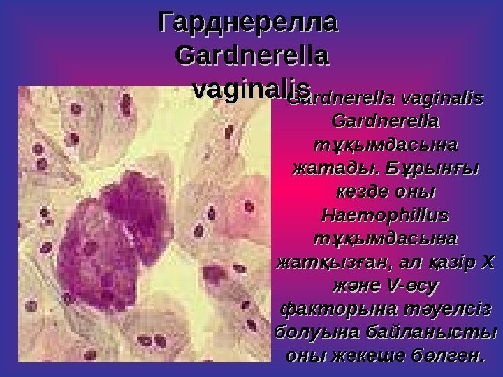   Gardnerella vaginalis Gardnerella  т ымдасыұқ на на жатады. Б рын ы