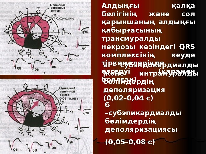 а – субэндокардиалды және интрамуралды бөлімдердің деполяризация (0, 02– 0, 04 с) б –субэпикардиалды