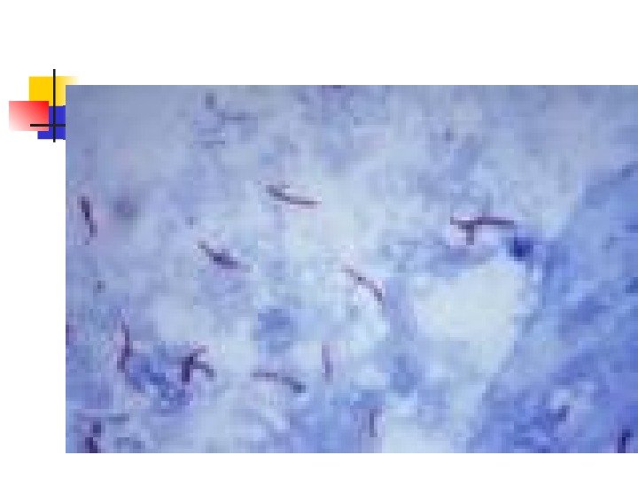 Mycobacterium tuberculosis.  Acid-fast stain  
