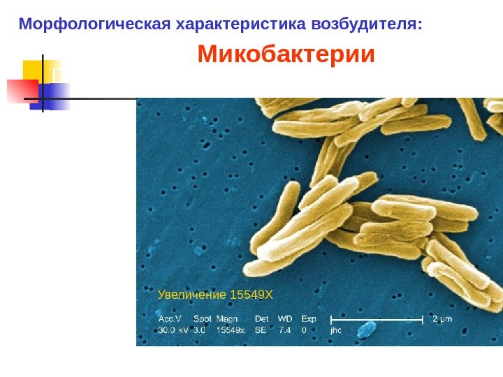 Полиморфные прямые или изогнутые палочки. Микобактерии  Сканирующая электронная микрофотография Mycobacterium tuberculosis. Увеличение 15549