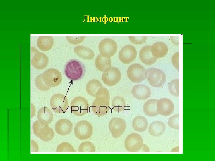   Лимфоцит  