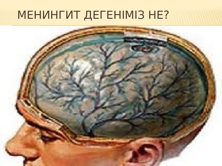 МЕНИНГИТ ДЕГЕНІМІЗ НЕ? 