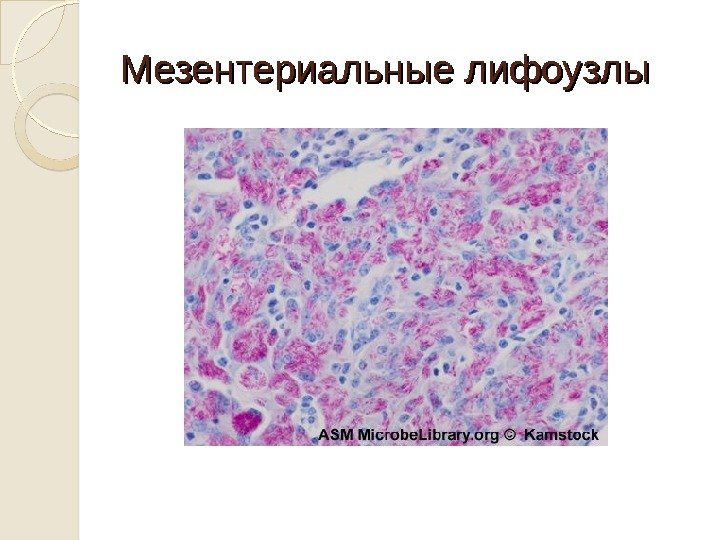 Мезентериальные лифоузлы 