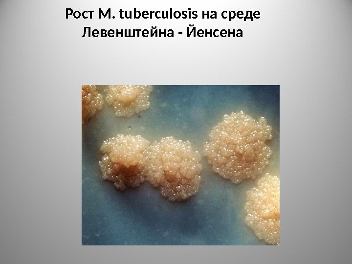 Рост M. tuberculosis на среде Левенштейна - Йенсена 