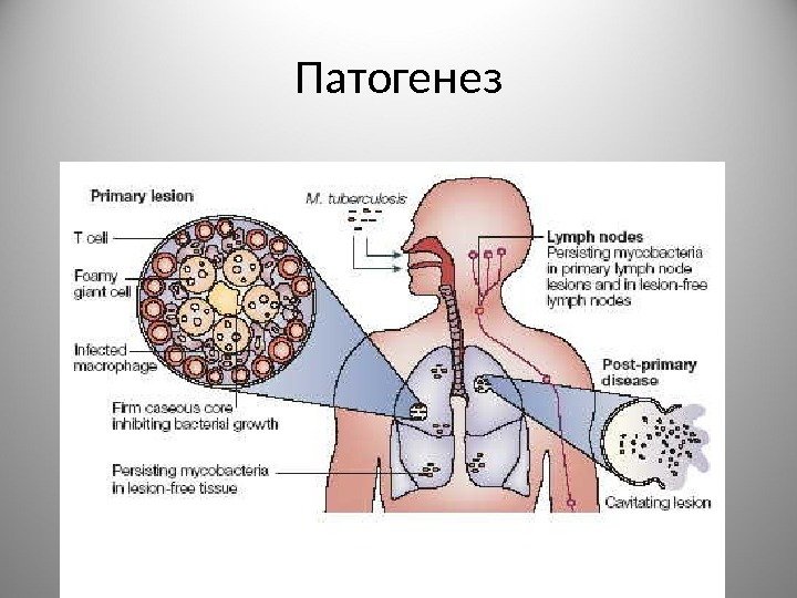 Патогенез 