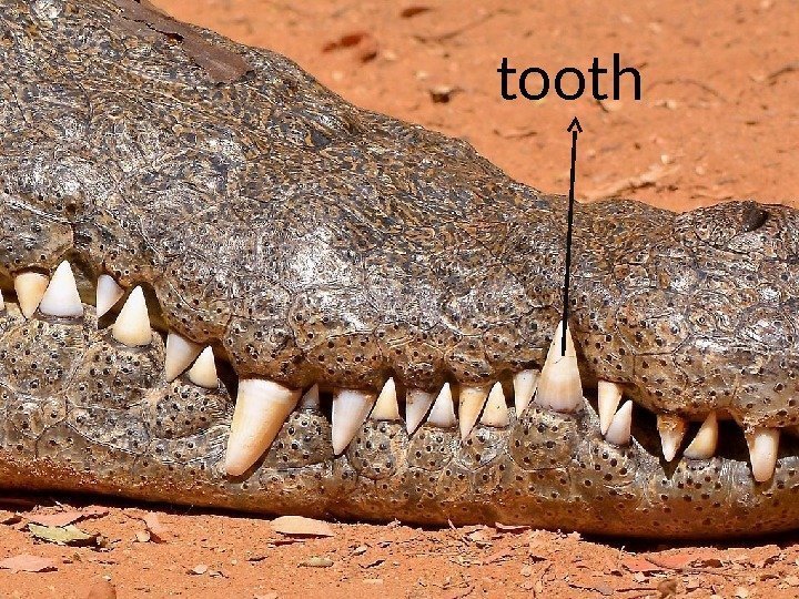 tooth 