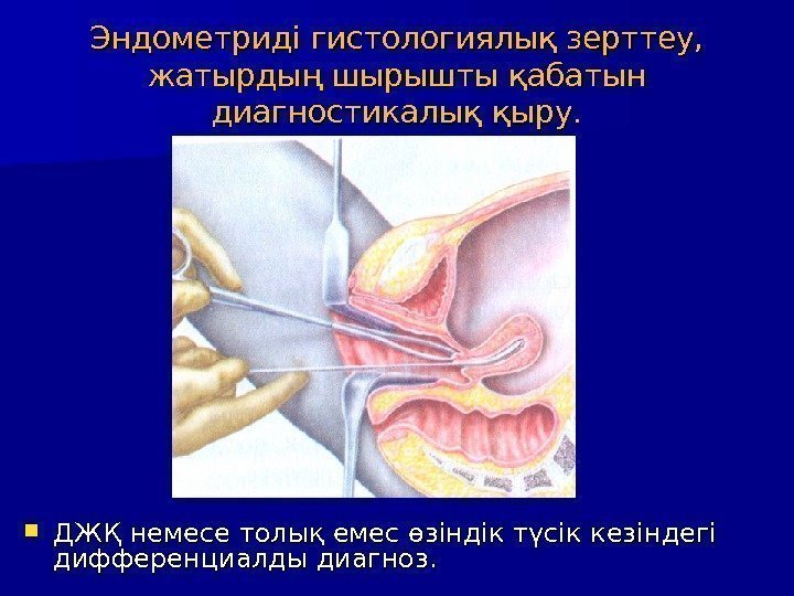 Эндометриді гистологиялық зерттеу,  жатырдың шырышты қабатын диагностикалық қыру.  ДЖҚ немесе толық емес