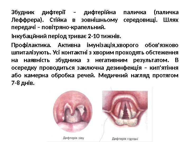 Збудник дифтерії – дифтерійна паличка (паличка Леффрера).  Стійка в зовнішньому середовищі.  Шлях