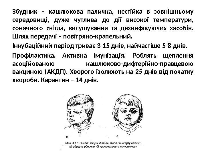 Збудник – кашлюкова паличка,  нестійка в зовнішньому середовищі,  дуже чутлива до дії