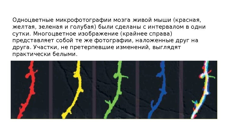 Одноцветные микрофотографии мозга живой мыши (красная,  желтая, зеленая и голубая) были сделаны с