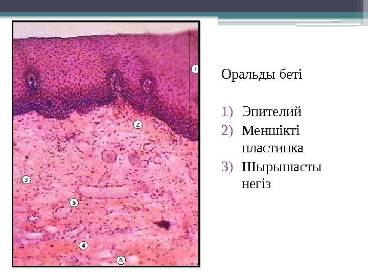 Оральды бетi 1) Эпителий 2) Меншiктi  пластинка 3) Шырышасты негіз   