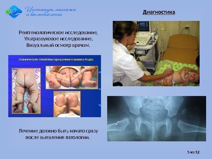 5 из 12 Рентгенологическое исследование,  Ультразвуковое исследование, Визуальный осмотр врачом. Диагностика Лечение должно