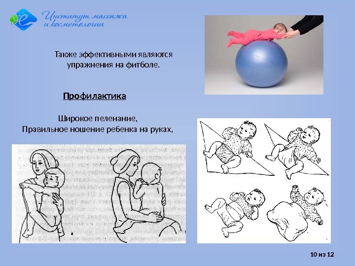 10 из 12 Широкое пеленание, Правильное ношение ребенка на руках, Профилактика. Также эффективными являются