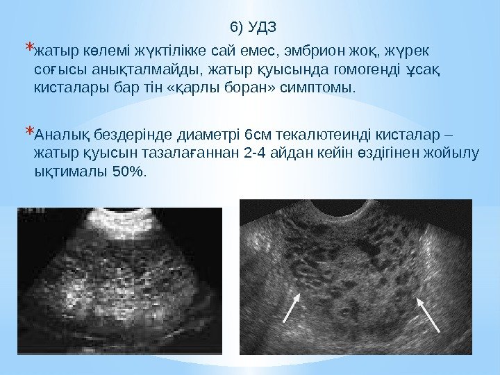 6) УДЗ * жатыр к лемі ж ктілікке сай емес, эмбрион жо , ж