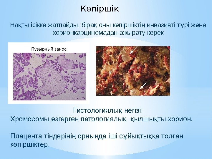 На ты ісікке жатпайды, біра оны к піршікті инвазивті т рі ж не қ