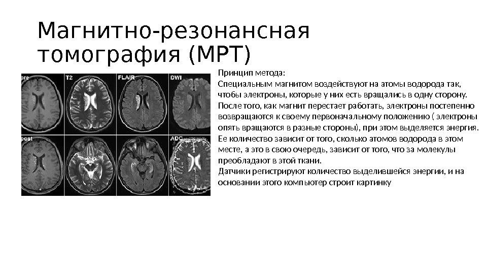 Магнитно-резонансная томография (МРТ) Принцип метода: Специальным магнитом воздействуют на атомы водорода так,  чтобы