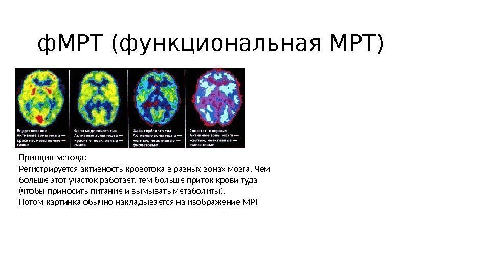 ф. МРТ (функциональная МРТ) Принцип метода: Регистрируется активность кровотока в разных зонах мозга. Чем