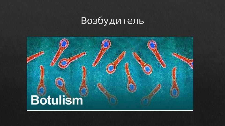 Возбудитель0 C  